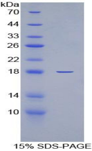 Recombinant Interleukin 6 Receptor (IL6R)