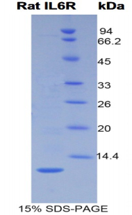 Recombinant Interleukin 6 Receptor (IL6R)