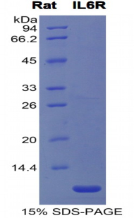 Recombinant Interleukin 6 Receptor (IL6R)