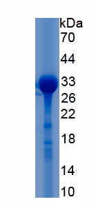 Recombinant Versican (VCAN)