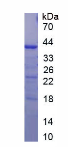 Recombinant Vascular Endothelial Growth Factor Receptor 1 (VEGFR1)