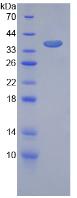 Recombinant Vascular Endothelial Growth Factor Receptor 1 (VEGFR1)