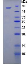 Recombinant Vascular Endothelial Growth Factor Receptor 1 (VEGFR1)