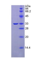 Recombinant Vascular Endothelial Growth Factor Receptor 1 (VEGFR1)