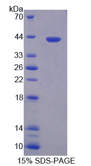 Recombinant Nuclear Factor Kappa B (NFkB)