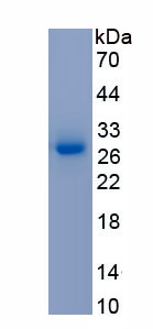 Recombinant Transglutaminase 2 (TGM2)