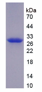 Recombinant Coagulation Factor XI (F11)