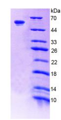 Recombinant Coagulation Factor XI (F11)