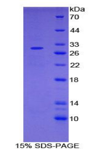 Recombinant Interleukin 2 Receptor Alpha (IL2Ra)