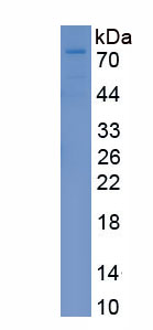 Recombinant Matrix Metalloproteinase 17 (MMP17)