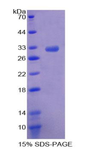 Recombinant Rho Associated Coiled Coil Containing Protein Kinase 2 (Rock2)