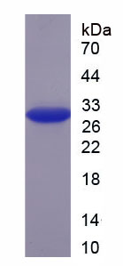 Recombinant Rho Associated Coiled Coil Containing Protein Kinase 2 (Rock2)