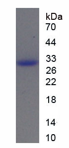 Recombinant Rho Associated Coiled Coil Containing Protein Kinase 2 (Rock2)