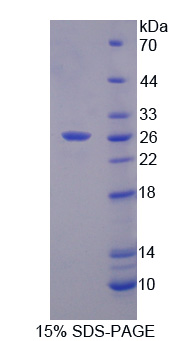 Recombinant Matrix Metalloproteinase 21 (MMP21)
