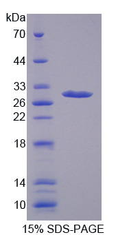 Recombinant Lectin Like Oxidized Low Density Lipoprotein Receptor 1 (LOX1)