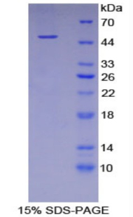 Recombinant Fetuin B (FETUB)