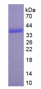 Recombinant Metallothionein 2 (MT2)