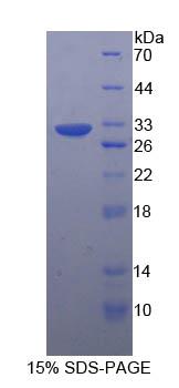 Recombinant Tubulin Beta (TUBb)