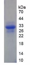 Recombinant Xeroderma Pigmentosum, Complementation Group G (XPG)