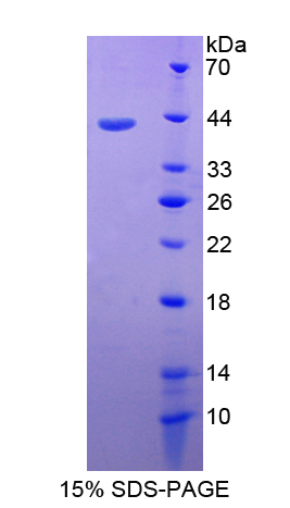 Recombinant Cluster Of Differentiation 3d (CD3d)