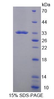 Recombinant Cluster Of Differentiation 19 (CD19)