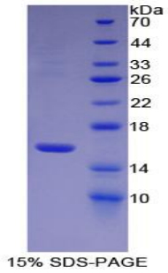 Recombinant Coagulation Factor VII (F7)