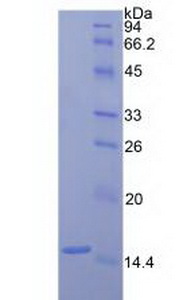 Recombinant Coagulation Factor VII (F7)