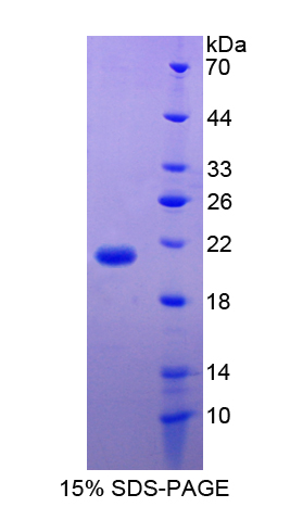 Recombinant Coagulation Factor VII (F7)