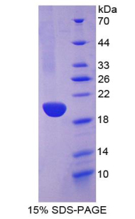 Recombinant Cytokeratin 13 (CK13)