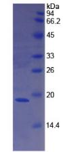 Recombinant Coagulation Factor VIII (F8)