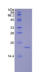 Recombinant Coagulation Factor VIII (F8)