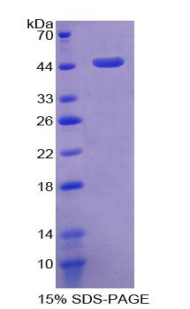 Recombinant Angiotensin I Converting Enzyme 2 (ACE2)