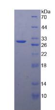 Recombinant Matrix Metalloproteinase 24 (MMP24)