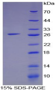 Recombinant Interferon Gamma Inducible Protein 16 (IFI16)