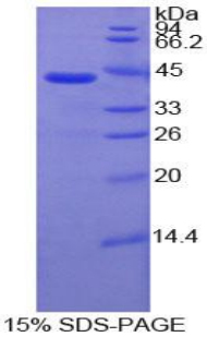 Recombinant Interleukin 7 Receptor (IL7R)