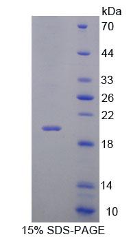 Recombinant Interleukin 7 Receptor (IL7R)