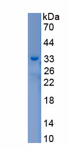 Recombinant Ficolin 2 (FCN2)