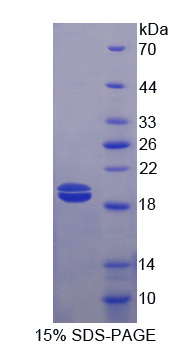 Recombinant Ficolin 2 (FCN2)