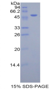 Recombinant Kallikrein 7 (KLK7)