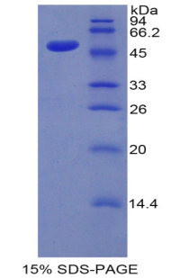 Recombinant Kallikrein 7 (KLK7)