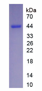 Recombinant Defensin Alpha 5, Paneth Cell Specific (DEFa5)