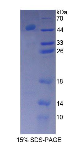 Recombinant Bruton'S Tyrosine Kinase (Btk)