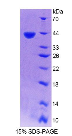 Recombinant Phosphatidylserine Receptor (PSR)