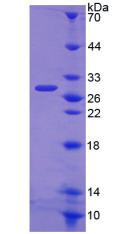 Recombinant Wiskott Aldrich Syndrome Protein (WASP)