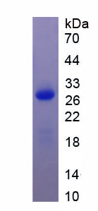 Recombinant Angiopoietin Like Protein 2 (ANGPTL2)