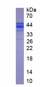 Recombinant Chemokine C-C-Motif Receptor 4 (CCR4)