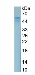 Recombinant Plakophilin 1 (PKP1)