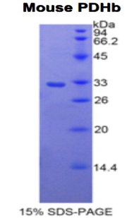 Recombinant Pyruvate Dehydrogenase Beta (PDHb)