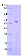 Recombinant Mothers Against Decapentaplegic Homolog 4 (Smad4)