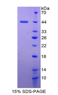 Recombinant Monokine Induced By Interferon Gamma (MIg)